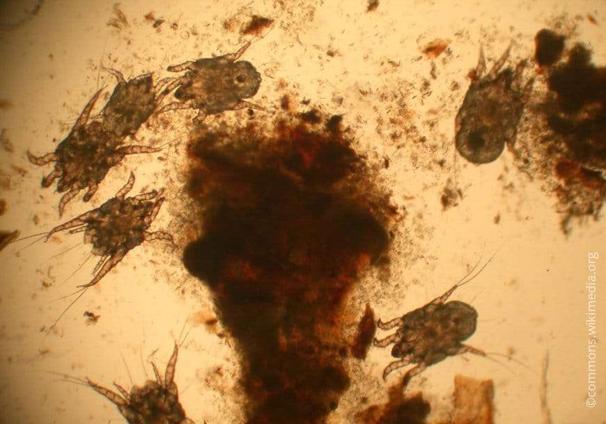 ear mites under a microscope